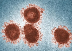 TEM of avian infectious bronchitis virus rotated cropped